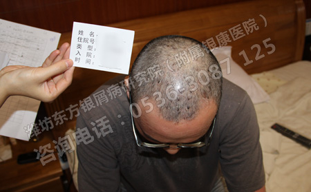 多喝水能预防银屑病的发生吗