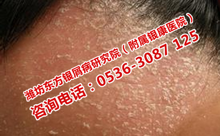 治疗牛皮癣可以的皮肤病医院