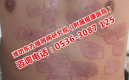 科学认识皮肤病的介绍
