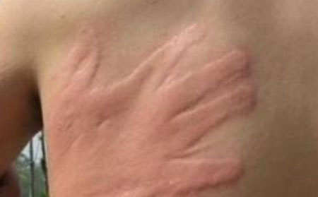 诸城皮防站效果可以吗