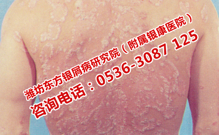 潍坊可以的皮肤病专科医院