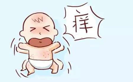 湿疹应该怎么进行护理