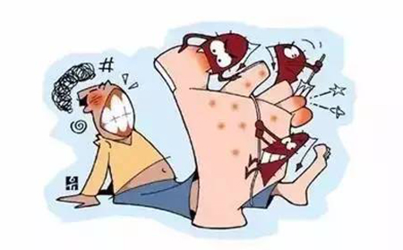 怎么治疗手足癣